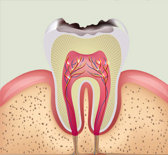 cabinet-dentaire-pricop-devitalisation-le-mans